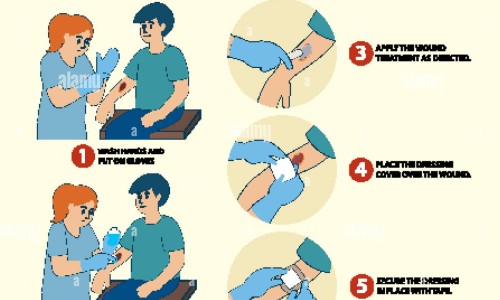 长期卧床身上起红疹子-久病卧床身上痒是怎么办,中国长期卧床后身上痒的厉害网站